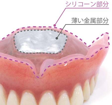 コンフォート ソケット